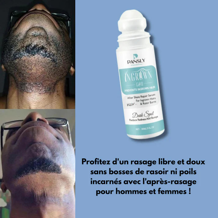 SERUM CONTRE LES ACNES ET LES POILES INCARNE APRES RASAGE ( Pansly )