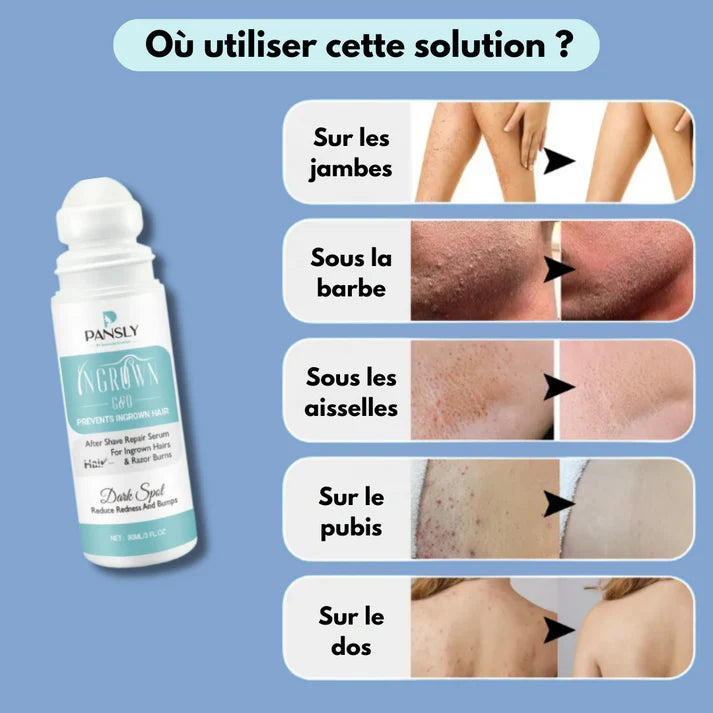 SERUM CONTRE LES ACNES ET LES POILES INCARNE APRES RASAGE ( Pansly )