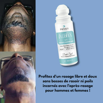SERUM CONTRE LES ACNES ET LES POILES INCARNE APRES RASAGE  ( Pansly )