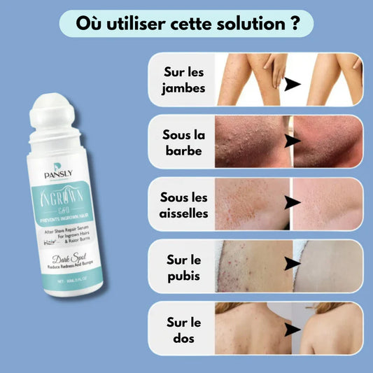 SERUM CONTRE LES ACNES ET LES POILES INCARNE APRES RASAGE  ( Pansly )